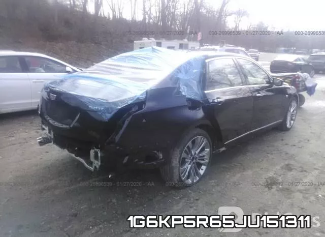 1G6KP5R65JU151311 фото 5