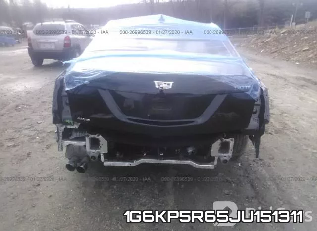 1G6KP5R65JU151311 фото 7