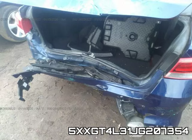 5XXGT4L31JG207354 фото 7
