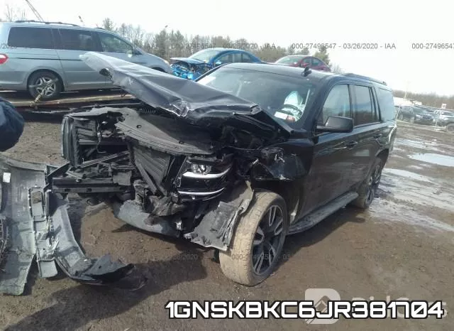 1GNSKBKC6JR381704 фото 3