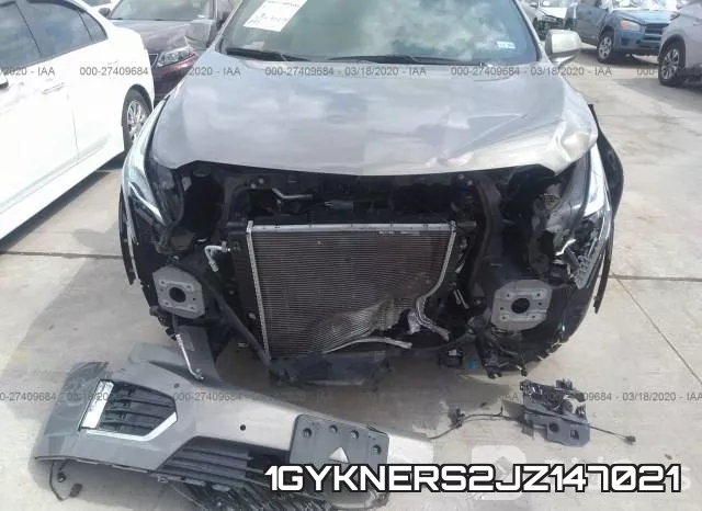1GYKNERS2JZ147021 фото 7