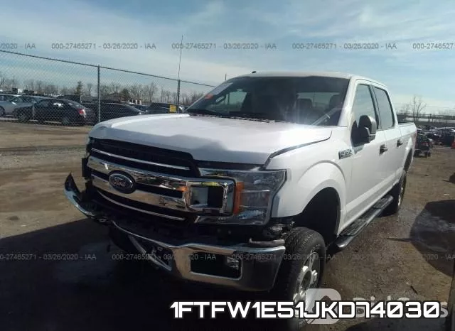 1FTFW1E51JKD74030 фото 3