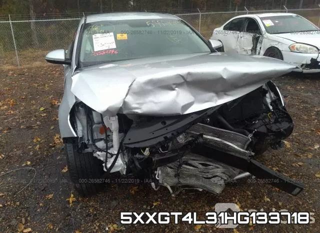 5XXGT4L31HG133718 фото 7
