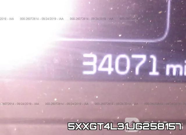 5XXGT4L31JG258157 фото 8