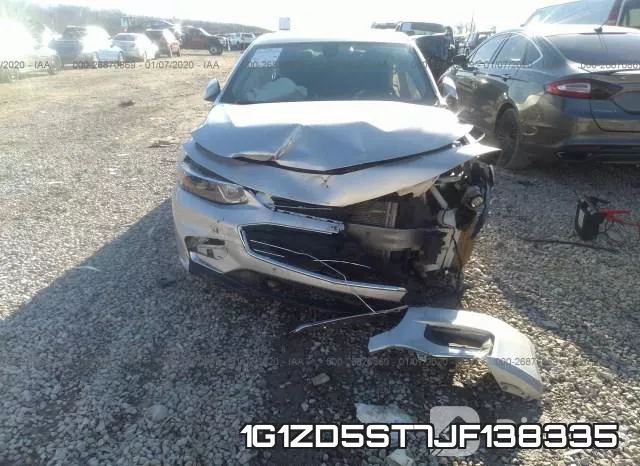 1G1ZD5ST7JF138335 фото 7