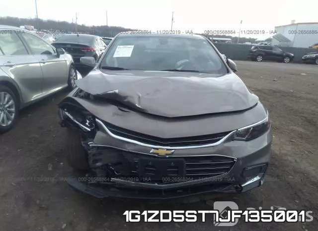 1G1ZD5ST7JF135001 фото 7