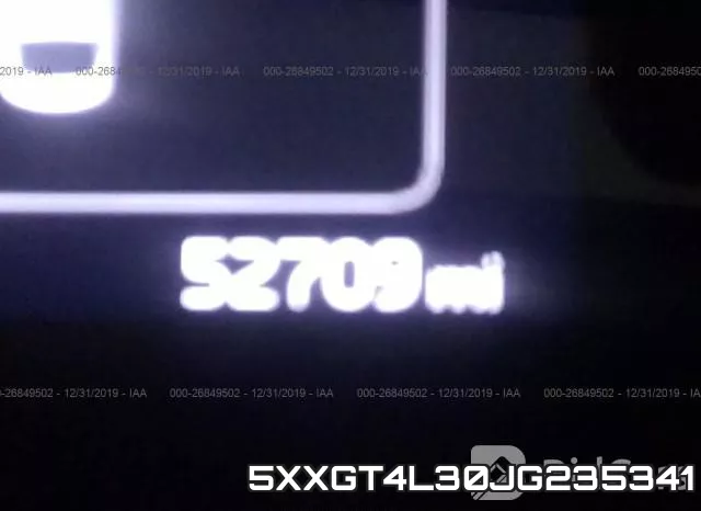 5XXGT4L30JG235341 фото 8