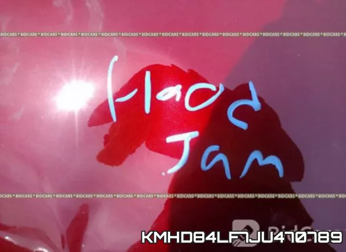 KMHD84LF7JU470789 фото 2