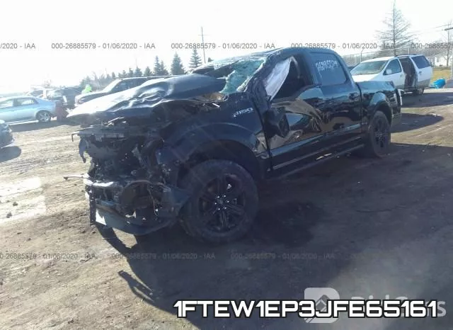 1FTEW1EP3JFE65161 фото 3