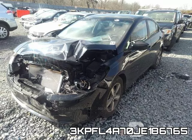 3KPFL4A70JE186765 фото 3