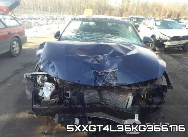 5XXGT4L36KG366176 фото 7