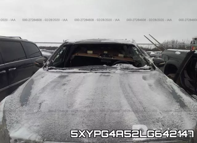 5XYPG4A52LG642147 фото 7