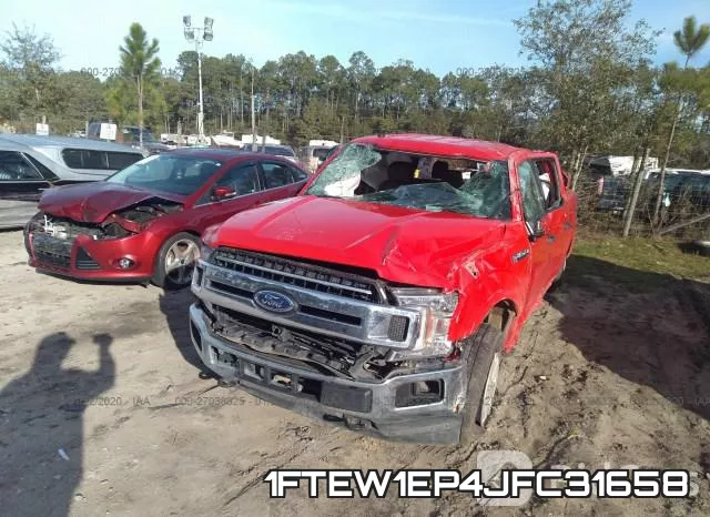 1FTEW1EP4JFC31658 фото 7