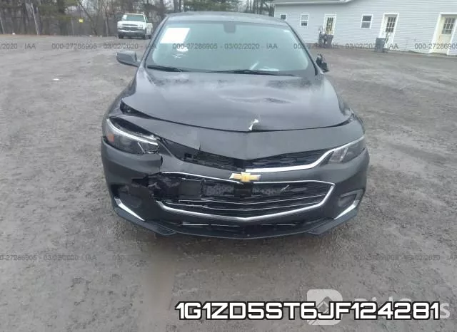 1G1ZD5ST6JF124281 фото 7