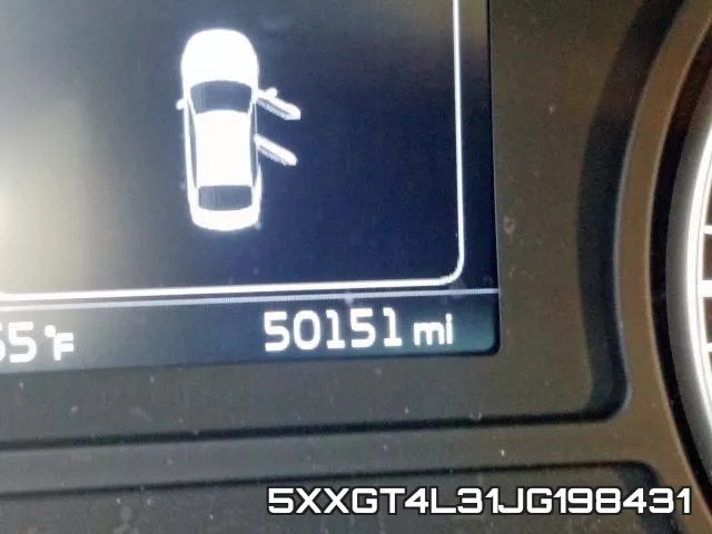 5XXGT4L31JG198431 фото 9