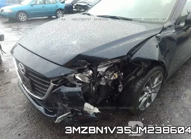 3MZBN1V35JM238604 фото 7