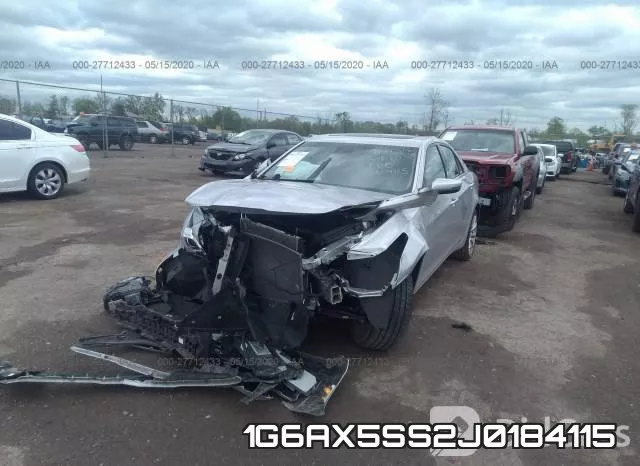 1G6AX5SS2J0184115 фото 3