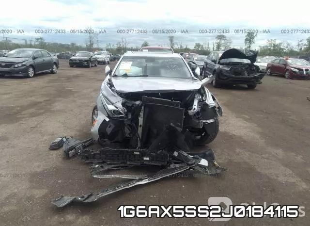1G6AX5SS2J0184115 фото 7