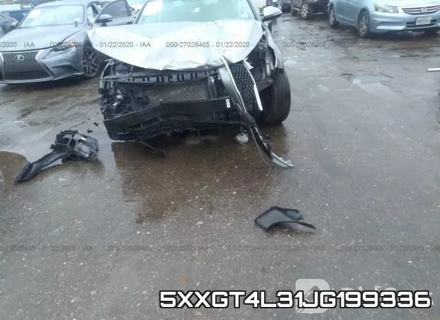5XXGT4L31JG199336 фото 7