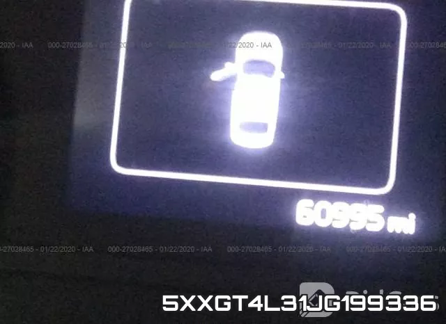 5XXGT4L31JG199336 фото 8