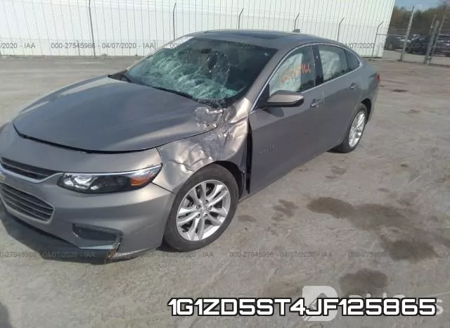 1G1ZD5ST4JF125865 фото 3