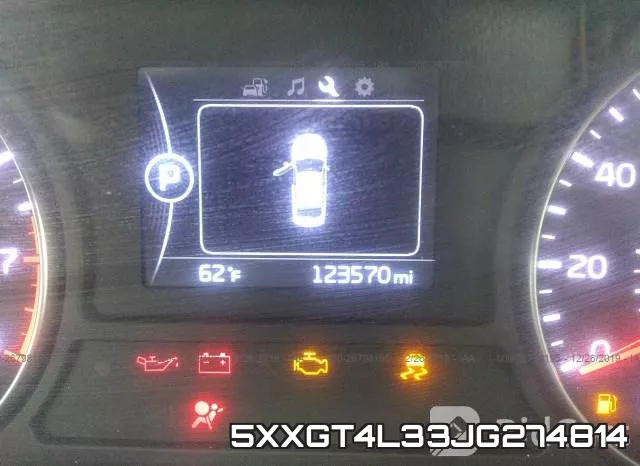 5XXGT4L33JG274814 фото 8