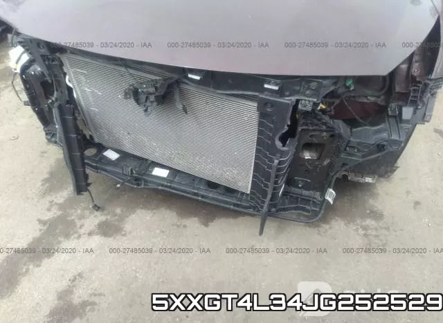 5XXGT4L34JG252529 фото 7