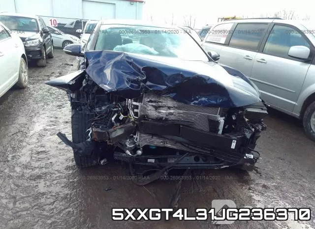 5XXGT4L31JG236370 фото 7