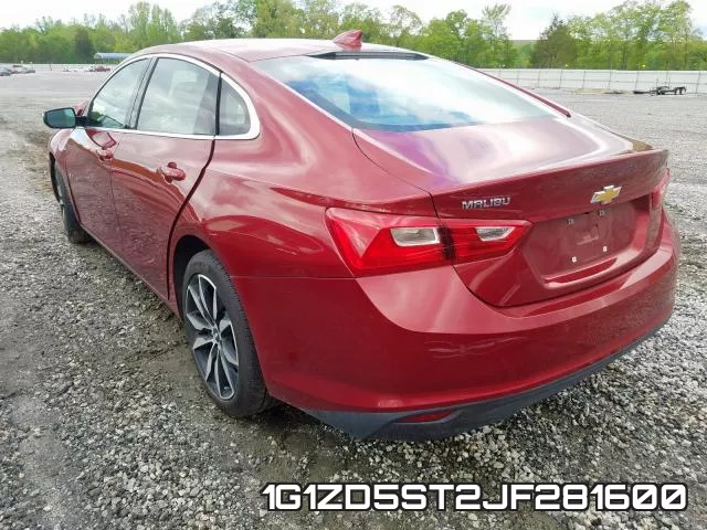 1G1ZD5ST2JF281600 фото 4