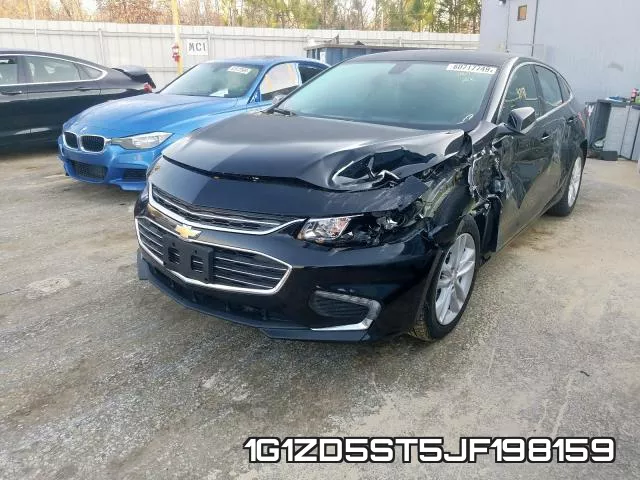 1G1ZD5ST5JF198159 фото 3