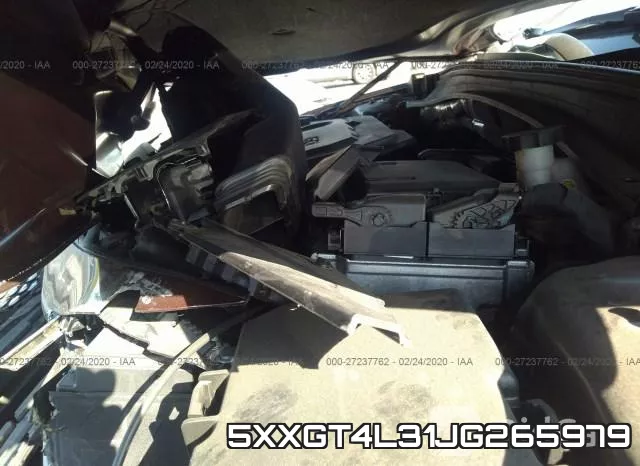 5XXGT4L31JG265979 фото 2