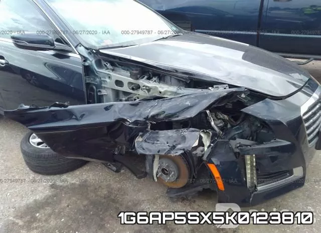 1G6AP5SX5K0123810 фото 7