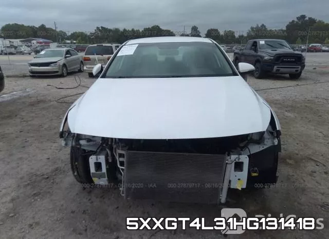 5XXGT4L31HG131418 фото 7