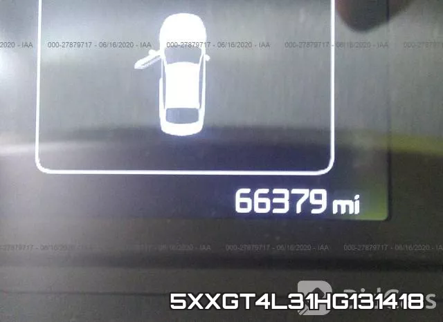 5XXGT4L31HG131418 фото 8