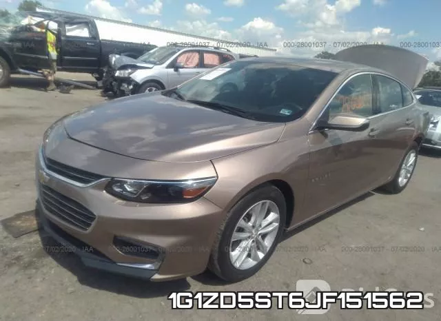 1G1ZD5ST6JF151562 фото 3