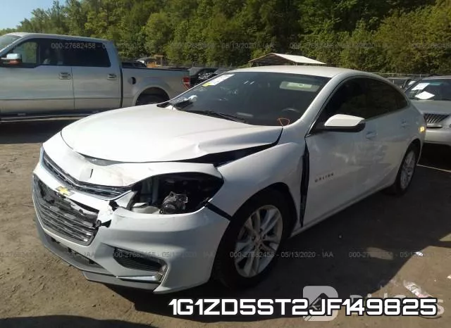 1G1ZD5ST2JF149825 фото 3