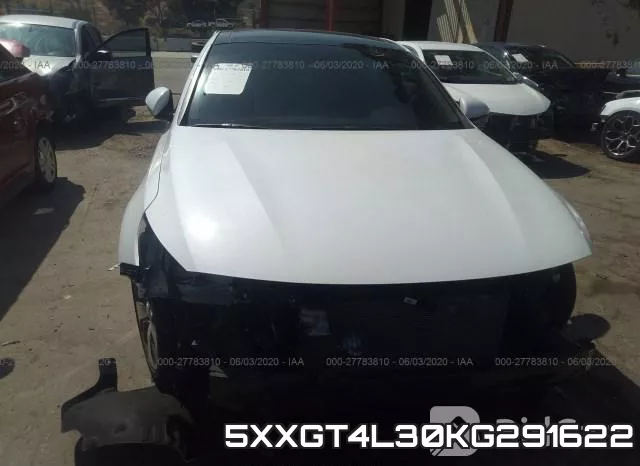 5XXGT4L30KG291622 фото 7