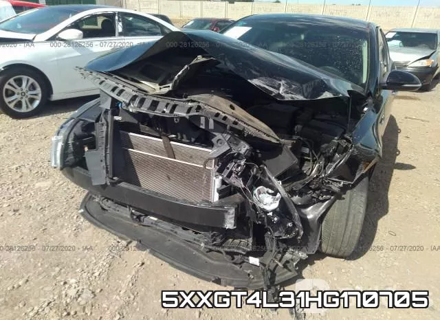 5XXGT4L31HG170705 фото 7