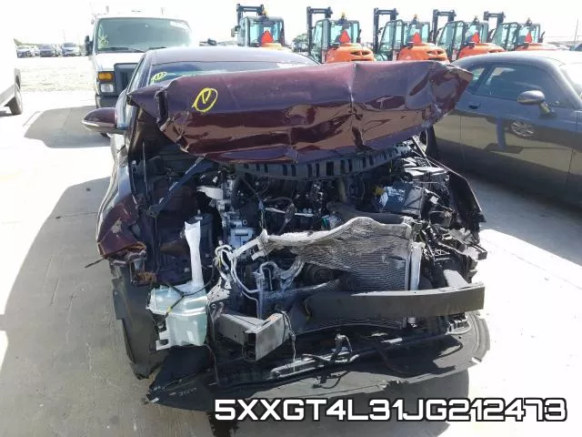 5XXGT4L31JG212473 фото 10