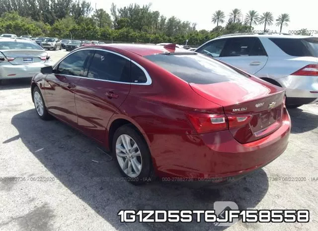 1G1ZD5ST6JF158558 фото 4