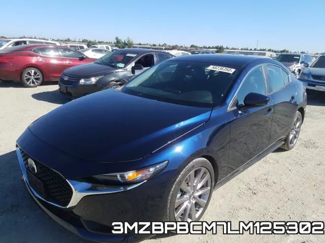 3MZBPBCM7LM125302 фото 3