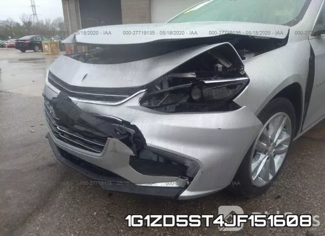 1G1ZD5ST4JF151608 фото 7