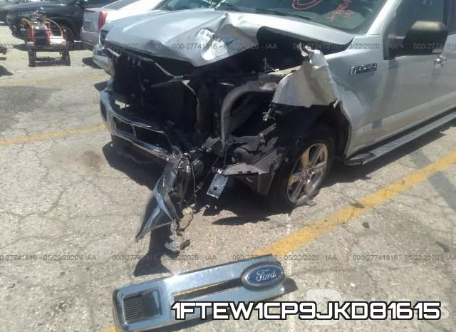 1FTEW1CP9JKD81615 фото 7