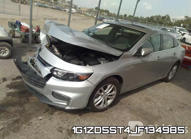 1G1ZD5ST4JF134985 фото 3