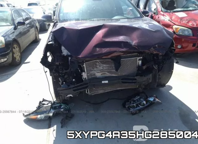 5XYPG4A35HG285004 фото 7