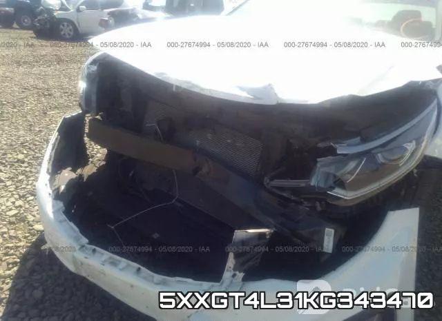 5XXGT4L31KG343470 фото 7