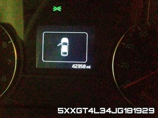 5XXGT4L34JG181929 фото 9