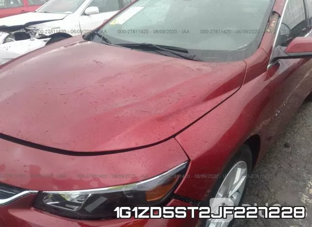 1G1ZD5ST2JF227228 фото 7