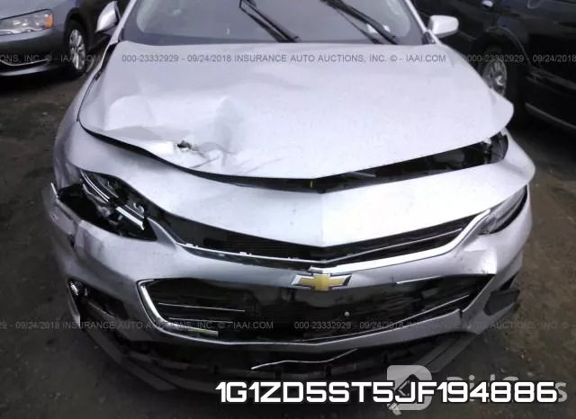 1G1ZD5ST5JF194886 фото 7