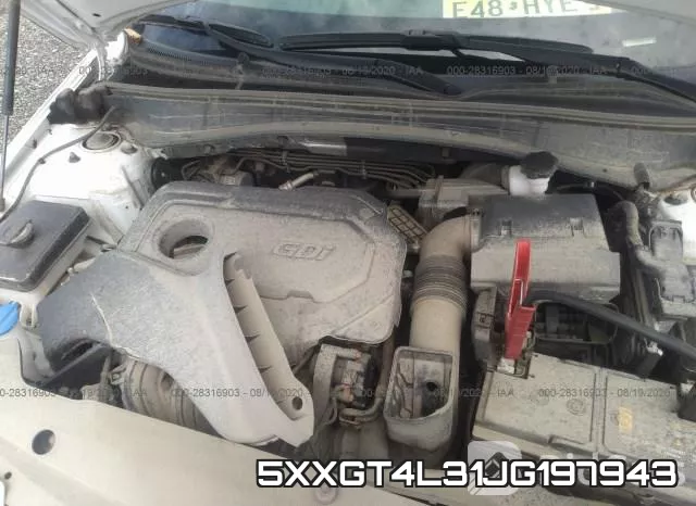 5XXGT4L31JG197943 фото 2